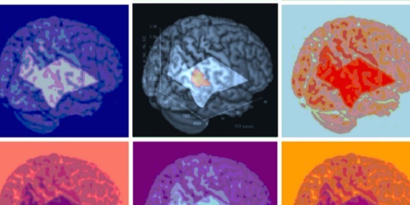 Anche il cervello ha la sua “impronta”